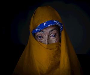 قومی اسمبلی نے تیزاب اور آگ سے جلانے کے جرائم کے خلاف تاریخی بل 2024 منظور کر لیا